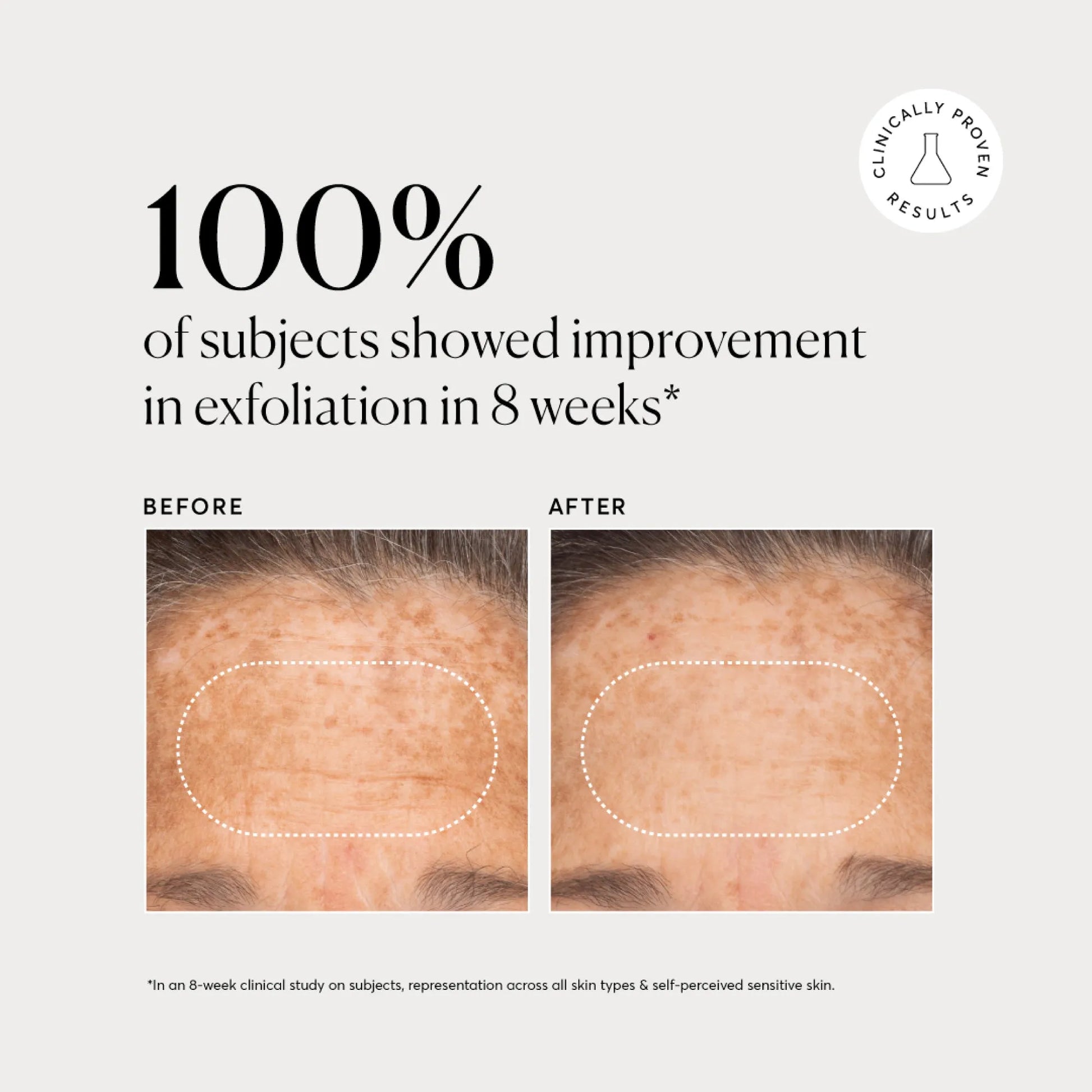 bha-liquid-exfoliant-2-g9 NATR-10027-Alt-Images-BHA-Liquid-Exfoliant-2_-03.webp