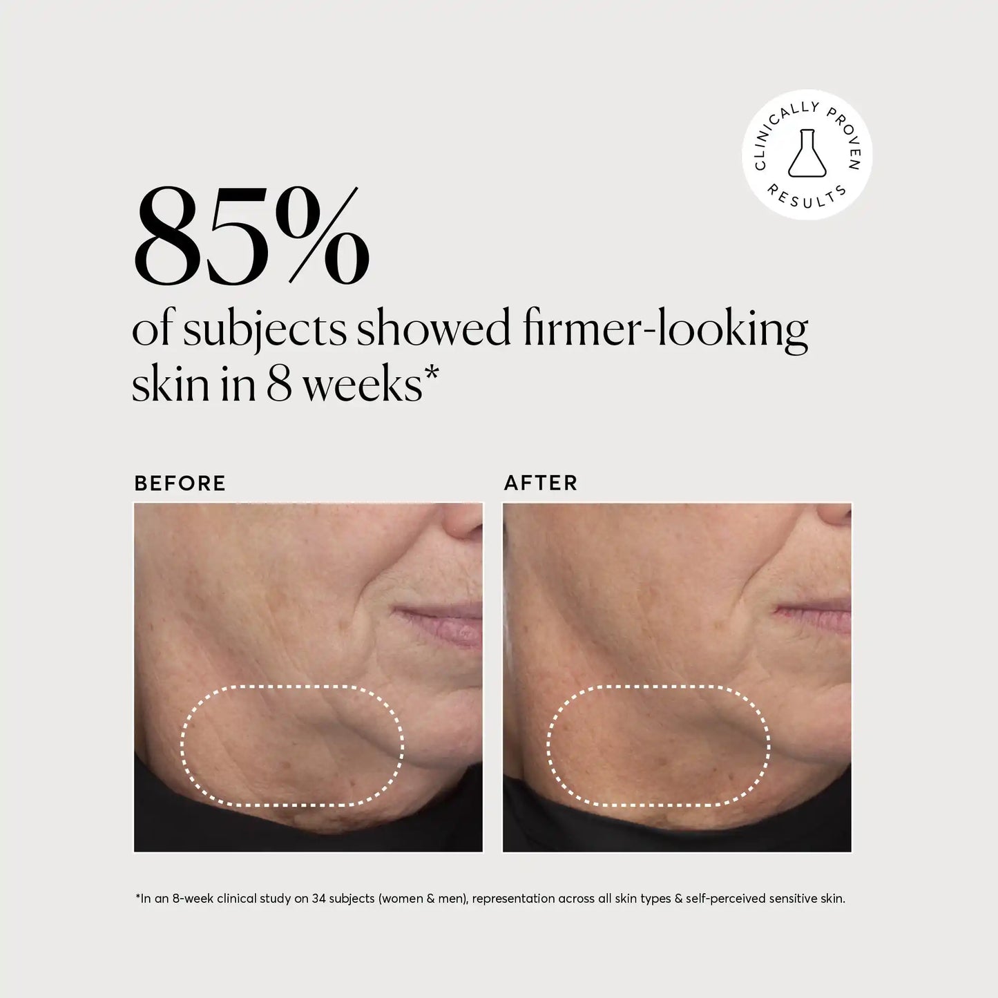 retinol-complex-serum-v3 NATR-10034-Alt-Images-Retinol-Complex-Serum-04.webp